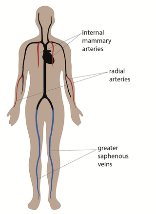 artery bypass graft sites