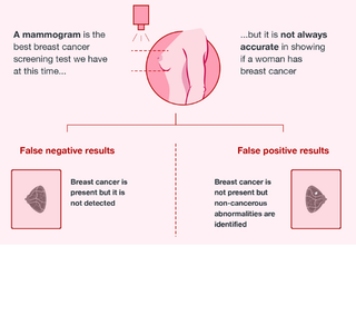 An infographic explaining what a mammogram false negative result and false positive result is.