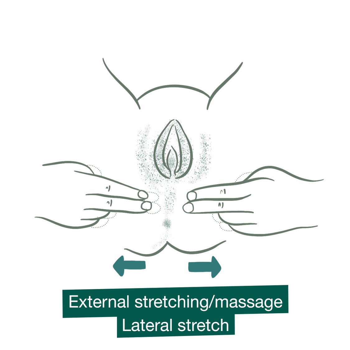 External Perineal Massage And Release Techniques For
