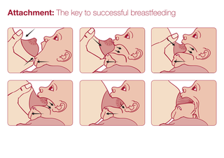 Incorrect posiion of the lips at the breast: narrow angle, shallow