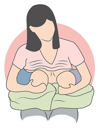 Twins breastfeeding in the double football position. The babies are lying on a pillow with their feet pointing outwards under the mother's arms. Their heads and back are supported by the mother's arms.