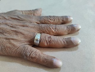 four fingers with fingernails that are curved over fingertips