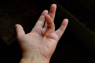 A hand with white skin held out flat with the ring finger bent in towards the palm.