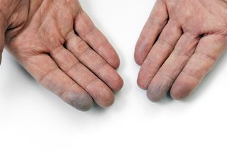 hands with blue fingertips