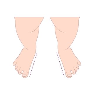Illustration of child standing with feet turned out