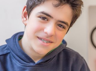 A boy with metal braces made up of brackets and wire and are glued to each tooth