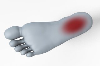 Diagram of the sole of a foot with a red oval on the heel area