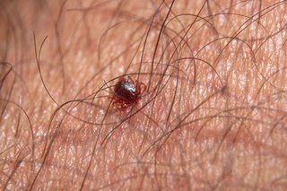 Small red tick attached to the skin.